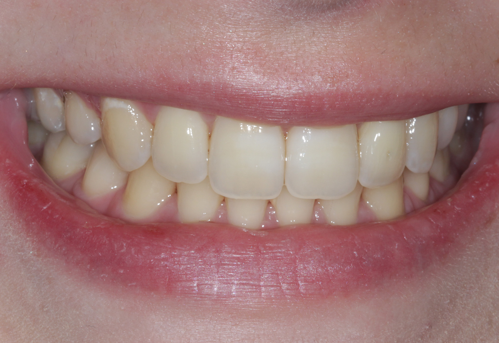 After — case 05