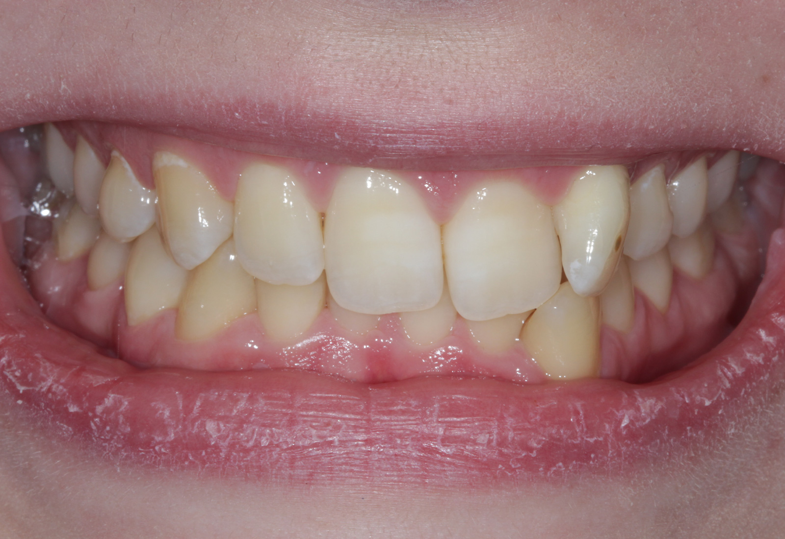 Before — case 09